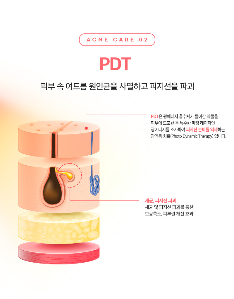 리엔장 여드름케어 PDT