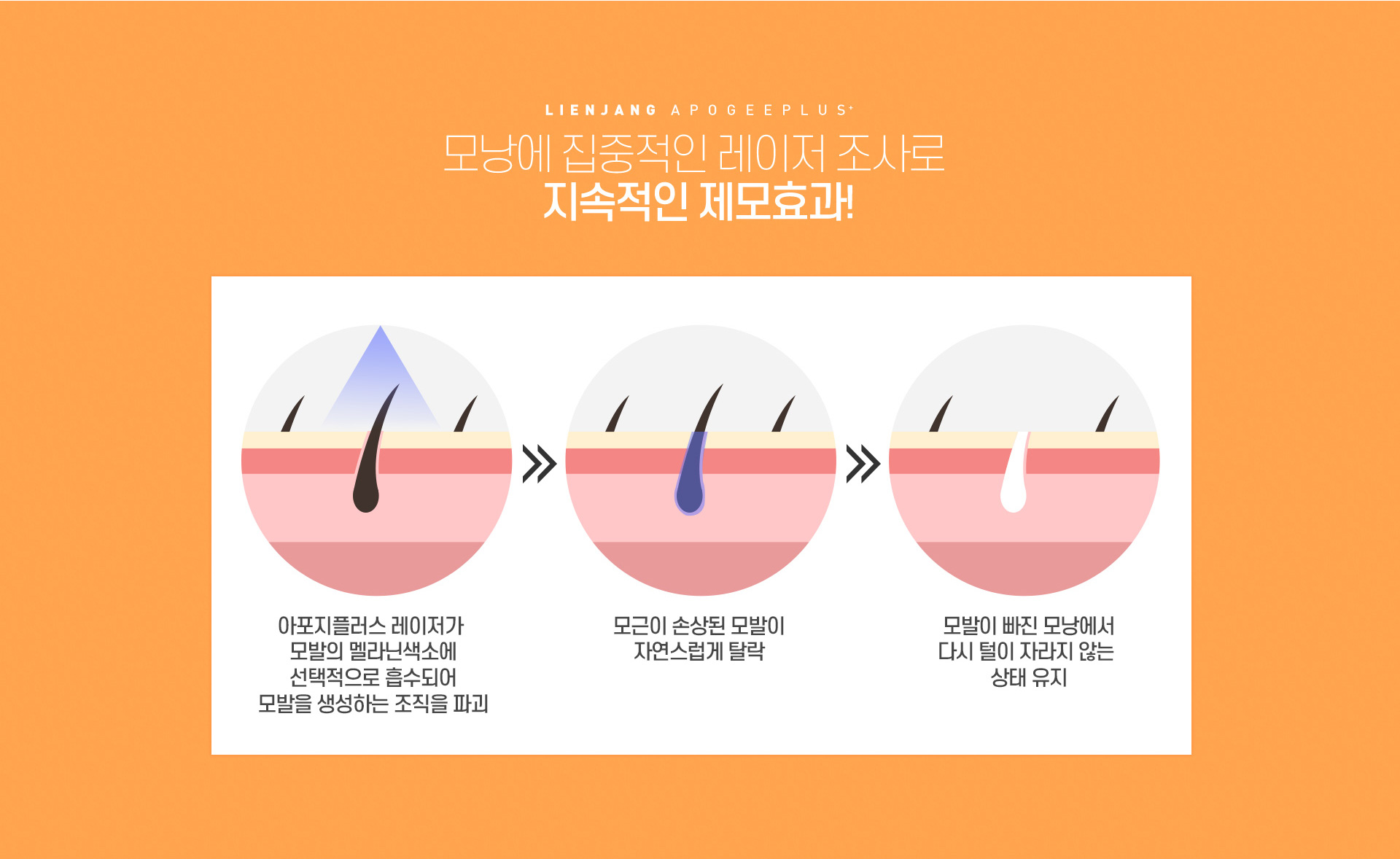 리엔장 아포지플러스 제모 효과