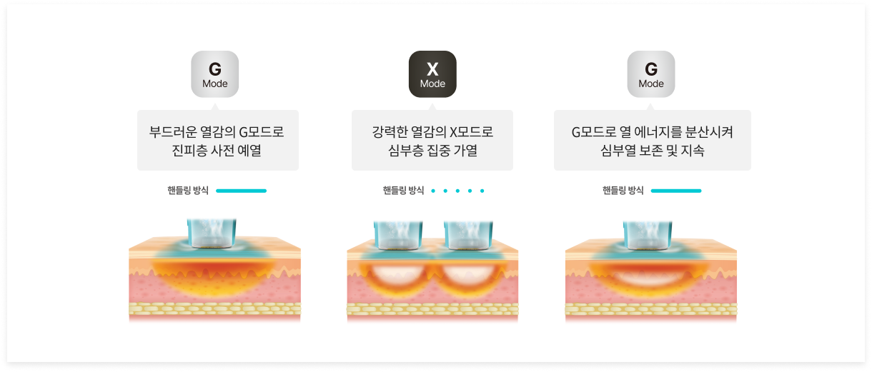 올리지오X 듀얼모드로 단계별 집중 시술 다이어그램