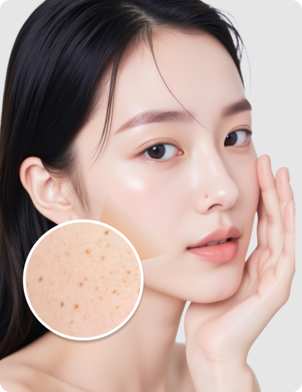 리엔장 피코토닝 소개 이미지