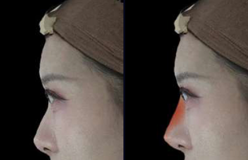 Meta Vu 가상 시뮬레이션 이미지