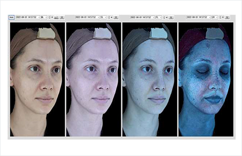 Meta Vu 4광원 피부분석 이미지