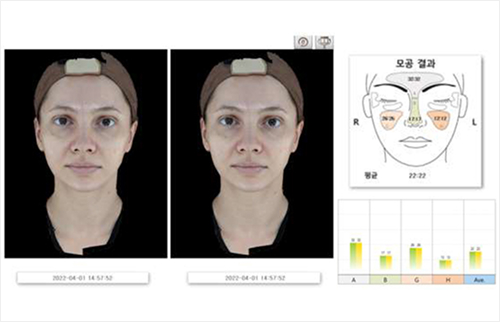 Meta Vu 비교분석 이미지